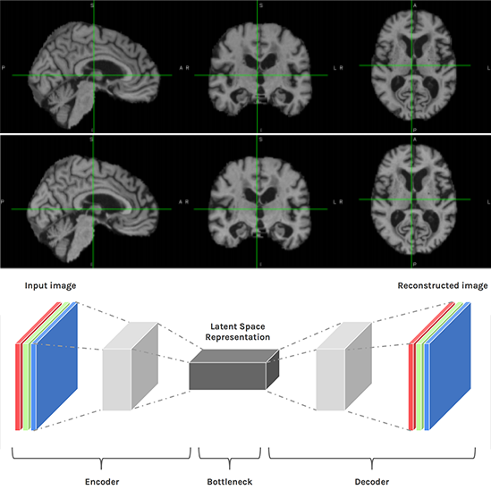 Brain registration, skullstripping, VAE autoencoder